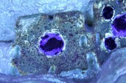 Skulptur — „Bildnisbüste der Amalbergis“ Detail Applikation am Diadem, während der UV- Fluoreszensuntersuchung