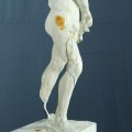 Plastik — „Entwurf zum Wildenbruchdenkmal“ (Vorzustand, Detail)